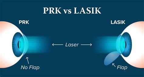 Download GameLoop from the official website, then run the exe file to install GameLoop. . Prk vs lasik reddit
